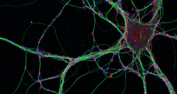Image of hippocampal neurons grown in culture and labeled for F-actin (red), presynaptic terminals bllue) and microtubules (green).  Image acquired by Katie Hsiao on a Zeiss LSM 780